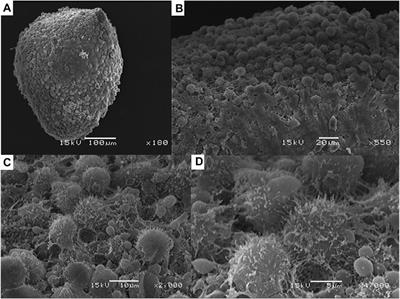 Case Report: Formation of 3D Osteoblast Spheroid Under Magnetic Levitation for Bone Tissue Engineering